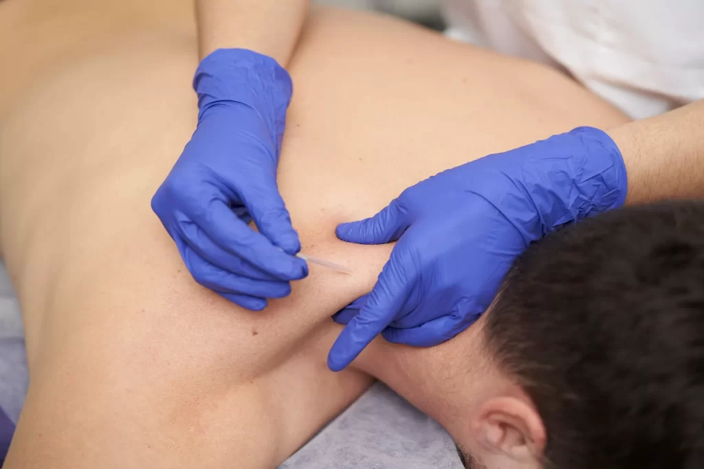 Técnicas empleadas en una sesión de fisioterapia a domicilio
