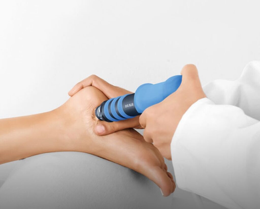 ¿Qué son las ondas de choque en fisioterapia?