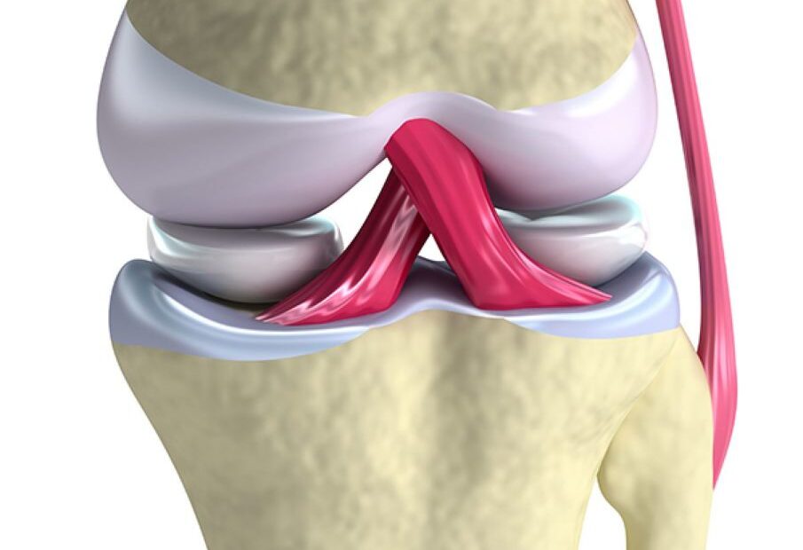 qué es el ligamento cruzado anterior y por qué es tan importante